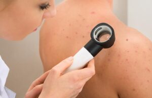 Σύστημα τεχνητής νοημοσύνης έκανε διάγνωση καρκίνου του δέρματος καλύτερα και από τους δερματολόγους