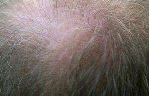 Μαλλιά τυπωμένα στο εργαστήριο