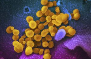 Δόθηκε έγκριση στο 1ο Φάρμακο Αντισωμάτων για τον COVID-19