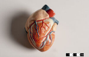 Κύτταρα «αναγέννησαν» την καρδιά μετά από καρδιακό επεισόδιο