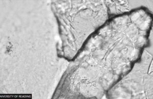 Τα ακάρεα, που ζευγαρώνουν στο πρόσωπό μας, έχουν ένα πρόβλημα