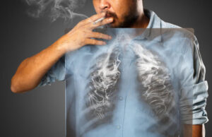 Αυξημένος ο κίνδυνος Αλτσχάιμερ και άνοιας για τους άνδρες καπνιστές