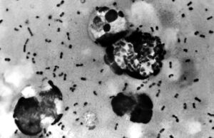 Μαύρη Πανώλη: Λύθηκε μυστήριο 675 ετών