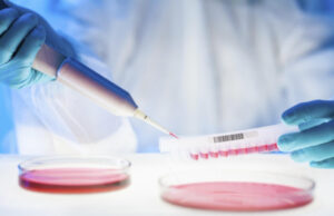 Καρκίνος του μαστού: Νέο φάρμακο υπόσχεται θαυματουργά αποτελέσματα σε προχωρημένο στάδιο