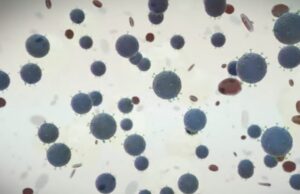 Σημαντική ανακάλυψη με ελληνική σφραγίδα: Κυτταρική θεραπεία δίνει ελπίδες για τα αυτοάνοσα νοσήματα