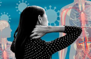 Το σύνδρομο της long-Covid αναμένεται να απασχολήσει αρκετά στο εγγύς μέλλον