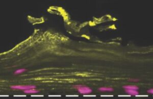 Ο γυναικείος κόλπος έγινε… τσιπάκι από επιστήμονες του Χάρβαρντ