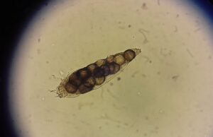 Όλα όσα δεν θέλατε ποτέ να μάθετε για τα ακάρεα που ζουν στο πρόσωπό σας