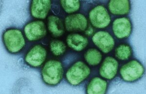 Μπορεί η ευλογιά των πιθήκων να εξελιχθεί σε πανδημία; Τι εκτιμά κορυφαίος βρετανός ειδικός