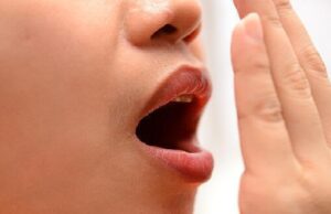 SOS: Τι μπορεί να κρύβει η κακοσμία στόματος – Από τι κινδυνεύουμε