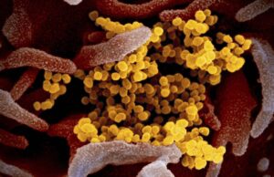 Κορωνοϊός: Γονίδιο «κληρονομιά» από τους Νεάντερταλ φαίνεται να προστατεύει από σοβαρή νόσο