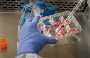 Απρόσμενο αποτέλεσμα σε μικρή μελέτη: Εξαφανίστηκε ο καρκίνος όλων των ασθενών