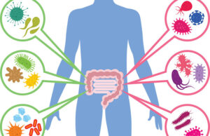 Σύνδρομο εντερικής διαρροής (leaky gut syndrome): Αιτίες και διάγνωση. Της Δρος Αικατερίνης Ρακά