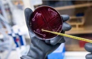 Δημιουργήθηκε στο εργαστήριο ανθρώπινο μικροβίωμα