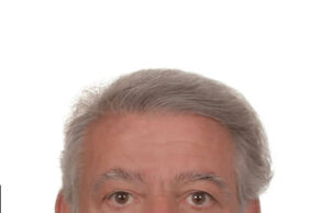 Το Αμερικάνικο Ινστιτούτο ΑIMIS καλωσορίζει τoν διακεκριμένο Γενικό Χειρουργό, Δρ. Νικόλαο Δάφνιο