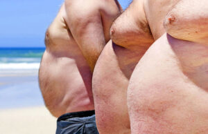 Η παχυσαρκία αναπτύσσεται ταχύτερα στην ύπαιθρο από ό,τι τις πόλεις