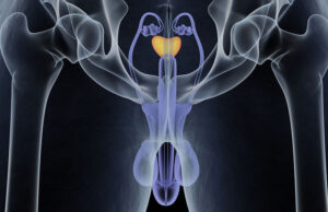 Ο ρόλος της απεικόνισης στον καρκίνο του προστάτη. Του δρα Στέλιου Δημητρίου