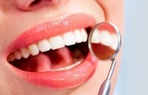 Τα προϊόντα λεύκανσης βλάπτουν τα δόντια… σε βάθος