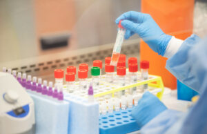 Κοροναϊός : Επηρεάζει σημαντικά και το αιμοποιητικό σύστημα, σύμφωνα με μελέτη του ΕΚΠΑ