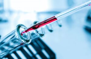 Βρετανία: Τεστ αίματος ανιχνεύει τον καρκίνο πριν εμφανιστούν κύρια συμπτώματα