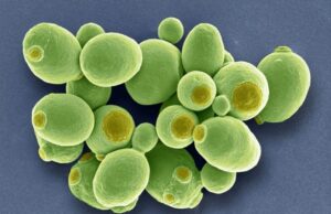 Καρκίνος: Μυστηριώδεις μύκητες βρέθηκαν να αναπτύσσονται μέσα στους όγκους