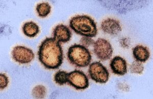 Το θαύμα επαναλαμβάνεται: Ακόμα ένας ασθενής θεραπεύτηκε πλήρως από τον HIV