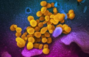 Μετά από τρία χρόνια πανδημίας, η προέλευση του κορωνοϊού παραμένει μυστήριο