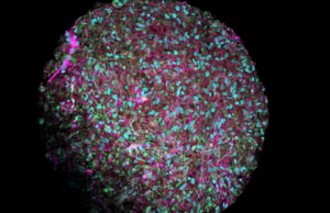 Βιολογικός υπολογιστής με εγκεφαλικά κύτταρα θα έχει «οργανοειδή νοημοσύνη»