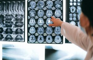 Τεχνητή νοημοσύνη με ελληνική συμμετοχή τα βάζει με καρκίνο του εγκεφάλου