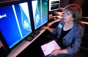 Τεχνητή νοημοσύνη: Εντοπισμός ιχνών καρκίνου του μαστού που οι γιατροί δεν μπορούν να δουν