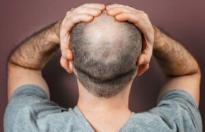 Φαλάκρα: Ερευνητές βρήκαν τον τρόπο να φυτρώνουν μαλλιά σε μόλις 10 ημέρες