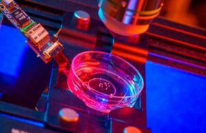 Πάρκινσον: Ενθαρρυντικά αποτελέσματα από θεραπεία βλαστοκυττάρων της Bayer