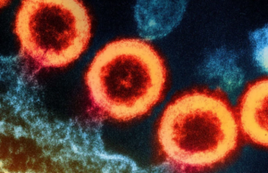 Ο ασθενής της Γενεύης είναι ο έκτος που θεραπεύτηκε από τον HIV