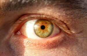 Γονιδιακή θεραπεία σε κολλύριο θεράπευσε τυφλό αγόρι