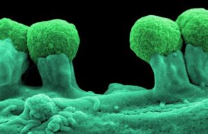 Τρόπους ελέγχου της εξάπλωσης των ανθεκτικών μικροβίων αναζητούν οι επιστήμονες