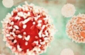 Επιστήμονες ανέπτυξαν χημειοθεραπεία ικανή να σκοτώσει όλους τους συμπαγείς καρκινικούς όγκους