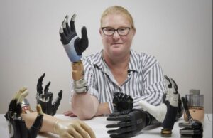 Σουηδή ζει με το πρώτο ρομποτικό χέρι που συνδέεται στον σκελετό (VIDEO)