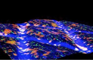 Βιολογικό «τσιρότο» επιδιορθώνει την κήλη δίσκου στη σπονδυλική στήλη