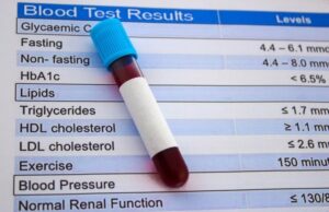 Ρηξικέλευθη θεραπεία έδειξε πως μπορεί να μάς σώσει από τη χοληστερόλη