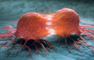 Επιστήμονες κατέστρεψαν το 99% των καρκινικών κυττάρων στο εργαστήριο