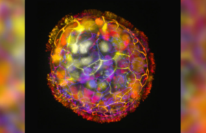 Anthrobots: Επιστήμονες έφτιαξαν ρομπότ από ανθρώπινα κύτταρα