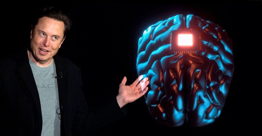 Η Neuralink έκανε την πρώτη επιτυχημένη μεταμόσχευση ασύρματου εγκεφαλικού εμφυτεύματος σε ασθενή