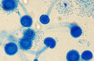 Μελέτη: Οι θάνατοι από μύκητες διπλασιάστηκαν σε μια δεκαετία