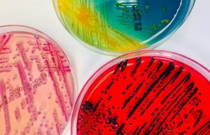 Δεκάδες άγνωστα βακτήρια ανακαλύφθηκαν σε ασθενείς νοσοκομείου