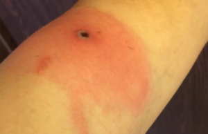 Ένας νέος ιός εξαπλώνεται στην Αλάσκα