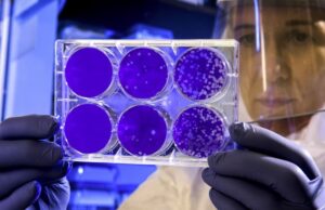 Klebsiella pneumoniae: Προειδοποίηση για θανατηφόρο ανθεκτικό βακτήριο που εξαπλώνεται στην Ευρώπη