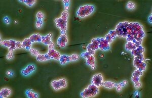 Παγκόσμια απειλή οι λοιμώξεις από ανθεκτικούς μύκητες