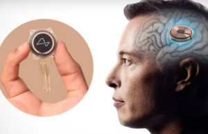 Neuralink: Η εταιρία του Elon Musk ετοιμάζει τσιπάκι για τον εγκέφαλο που θα κάνει τυφλούς να βλέπουν