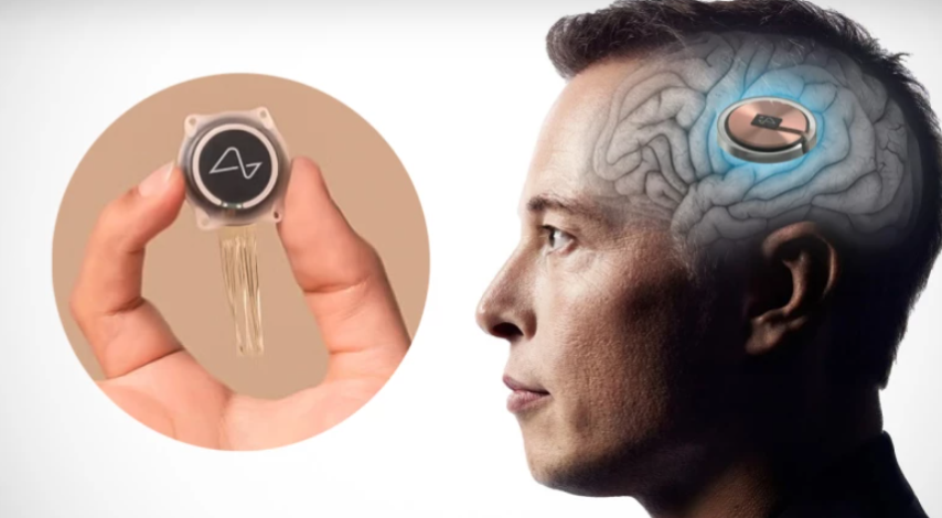 Neuralink: Η εταιρία του Elon Musk ετοιμάζει τσιπάκι για τον εγκέφαλο που θα κάνει τυφλούς να βλέπουν