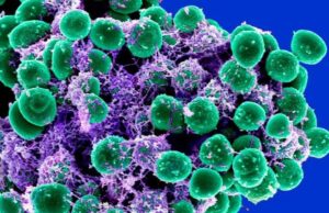 Ανθεκτικά βακτήρια: Ποια υπάρχοντα φάρμακα τα εξολοθρεύουν καλύτερα από αντιβιοτικά